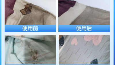 酶制劑在醫(yī)療器械清洗劑中的作用，您了解多少？